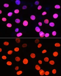 Anti-Histone H3R2me2 (Symmetric Di-methyl Arg2) antibody used in Immunocytochemistry/ Immunofluorescence (ICC/IF). GTX33905