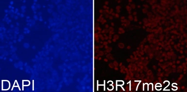 Anti-Histone H3R17me2 (Symmetric Di-methyl Arg17) antibody used in Immunocytochemistry/ Immunofluorescence (ICC/IF). GTX33907