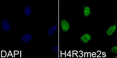 Anti-Histone H4R3me2 (Symmetric dimethyl Arg3) antibody used in Immunocytochemistry/ Immunofluorescence (ICC/IF). GTX33909