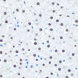 Anti-Histone H4R3me2 (Symmetric dimethyl Arg3) antibody used in IHC (Paraffin sections) (IHC-P). GTX33909