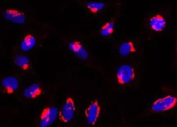 Anti-RAB6 (Q72L mutant specific) antibody [AA2] used in Immunocytochemistry/ Immunofluorescence (ICC/IF). GTX33942