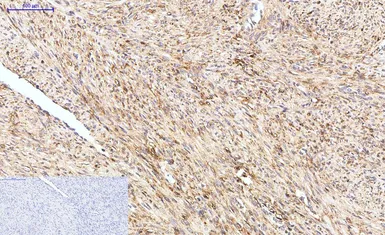 Anti-HAO1 antibody [Mix] used in IHC (Paraffin sections) (IHC-P). GTX33987