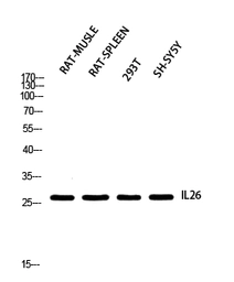 Anti-IL26 antibody used in Western Blot (WB). GTX34013