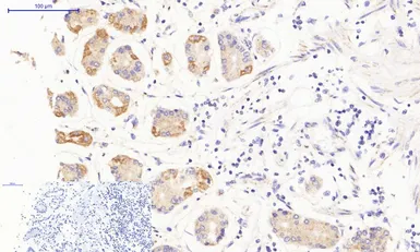 Anti-JAK3 antibody used in IHC (Paraffin sections) (IHC-P). GTX34020