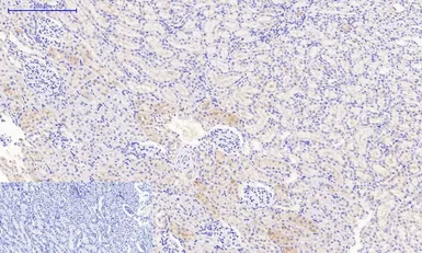 Anti-JAK3 antibody used in IHC (Paraffin sections) (IHC-P). GTX34020