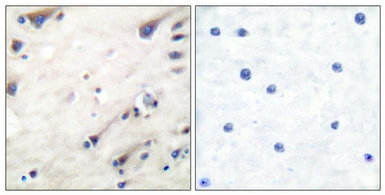 Anti-KSR1 antibody used in IHC (Paraffin sections) (IHC-P). GTX34028