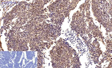 Anti-Survivin antibody [Mix] used in IHC (Paraffin sections) (IHC-P). GTX34059