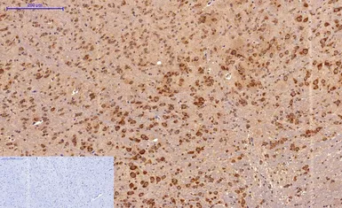 Anti-Survivin antibody [Mix] used in IHC (Paraffin sections) (IHC-P). GTX34059