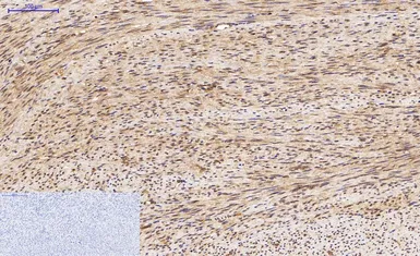 Anti-LC3A antibody [5G10] used in IHC (Paraffin sections) (IHC-P). GTX34067