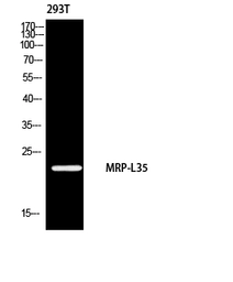 Anti-MRPL35 antibody used in Western Blot (WB). GTX34086