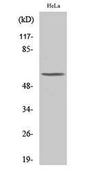Anti-PLK5 antibody used in Western Blot (WB). GTX34126