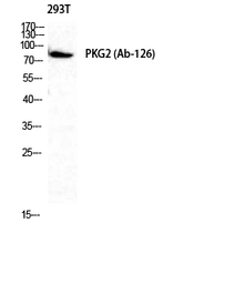 Anti-CGK2 antibody used in Western Blot (WB). GTX34143