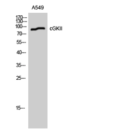 Anti-CGK2 antibody used in Western Blot (WB). GTX34143