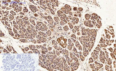 Anti-Caspase 9 antibody [3-20] used in IHC (Paraffin sections) (IHC-P). GTX34168