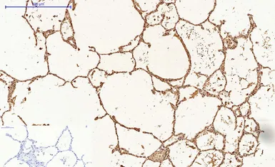 Anti-Caspase 9 antibody [3-20] used in IHC (Paraffin sections) (IHC-P). GTX34168