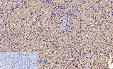 Anti-Caspase 9 antibody [3-20] used in IHC (Paraffin sections) (IHC-P). GTX34168