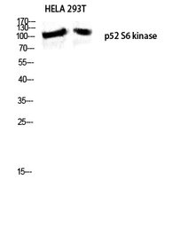 Anti-RPS6KC1 antibody used in Western Blot (WB). GTX34179