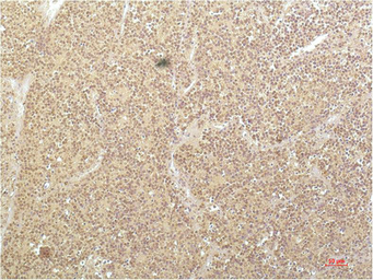 Anti-SGK1 antibody [4D12] used in IHC (Paraffin sections) (IHC-P). GTX34195