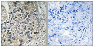 Anti-ARALAR antibody used in IHC (Paraffin sections) (IHC-P). GTX34202