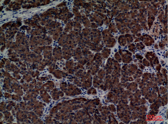 Anti-CD1E antibody used in IHC (Paraffin sections) (IHC-P). GTX34207