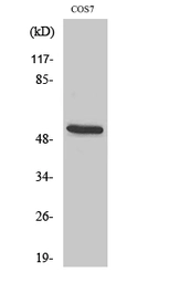 Anti-CD2BP2 antibody used in Western Blot (WB). GTX34212