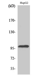 Anti-TOP3B antibody used in Western Blot (WB). GTX34277