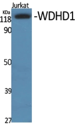 Anti-WDHD1 antibody used in Western Blot (WB). GTX34296