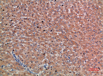 Anti-Chordin antibody used in IHC (Paraffin sections) (IHC-P). GTX34306