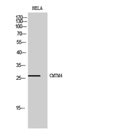 Anti-CMTM4 antibody used in Western Blot (WB). GTX34320
