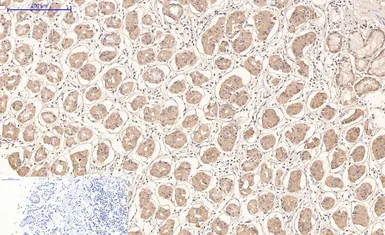 Anti-CD21 antibody [2C5] used in IHC (Paraffin sections) (IHC-P). GTX34330