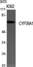 Anti-CYP39A1 antibody used in Western Blot (WB). GTX34347