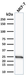 Anti-Bcl-2 antibody [SPM117] used in Western Blot (WB). GTX34426