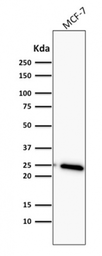 Anti-Bcl-2 antibody [BCL2/782] used in Western Blot (WB). GTX34429