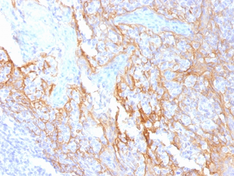 Anti-beta Catenin antibody [15B8] used in IHC (Paraffin sections) (IHC-P). GTX34439