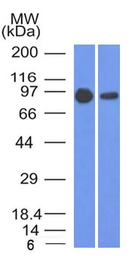 Anti-beta Catenin antibody [5H10] used in Western Blot (WB). GTX34440