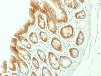 Anti-beta Catenin antibody [CTNNB1/1507] used in IHC (Paraffin sections) (IHC-P). GTX34442