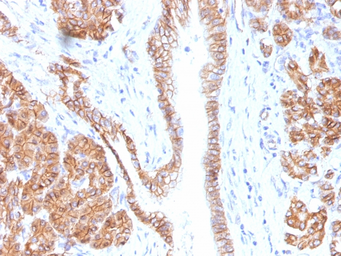 Anti-beta Catenin antibody [CTNNB1/1508] used in IHC (Paraffin sections) (IHC-P). GTX34443