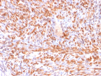 Anti-Calponin 1 antibody [rCNN1/832] used in IHC (Paraffin sections) (IHC-P). GTX34449