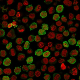 Anti-Calponin 1 antibody [CNN1/1408R] used in Immunocytochemistry/ Immunofluorescence (ICC/IF). GTX34450