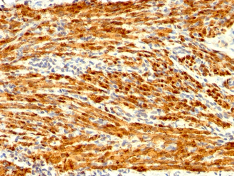 Anti-Calponin 1 antibody [CNN1/1408R] used in IHC (Paraffin sections) (IHC-P). GTX34450