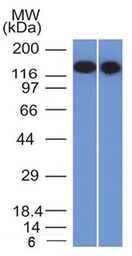 Anti-CD22 antibody [BLCAM/1795] used in Western Blot (WB). GTX34478