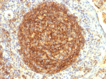 Anti-CD35 antibody [CR1/802] used in IHC (Paraffin sections) (IHC-P). GTX34504