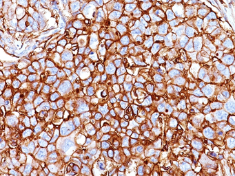 Anti-CD44 antibody [HCAM/918] used in IHC (Paraffin sections) (IHC-P). GTX34516