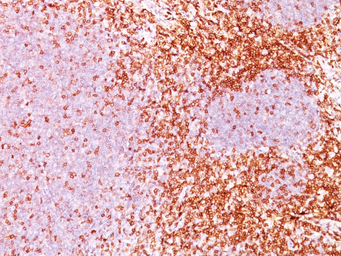 Anti-CD6 antibody [3F7B5] used in IHC (Paraffin sections) (IHC-P). GTX34535