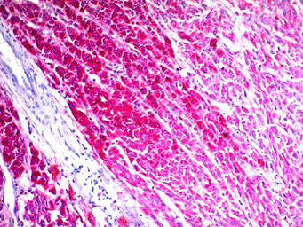 Anti-CD63 antibody [SPM524] used in IHC (Paraffin sections) (IHC-P). GTX34539