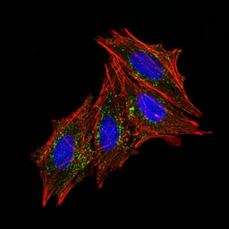 Anti-CD63 antibody [MX-49.129.5] used in Immunocytochemistry/ Immunofluorescence (ICC/IF). GTX34540