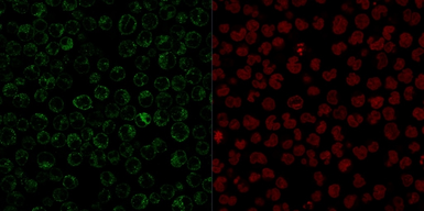 Anti-CD79a antibody [JCB117] used in Immunocytochemistry/ Immunofluorescence (ICC/IF). GTX34556