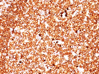 Anti-CD79a antibody [SPM549] used in IHC (Paraffin sections) (IHC-P). GTX34557