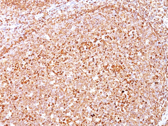 Anti-CD79a antibody [SPM550] used in IHC (Paraffin sections) (IHC-P). GTX34558