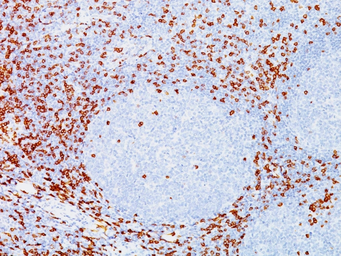 Anti-CD8 alpha antibody [C8/144B] used in IHC (Paraffin sections) (IHC-P). GTX34567
